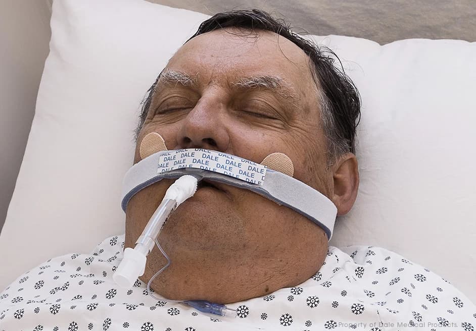 Endotracheal Tube Holders