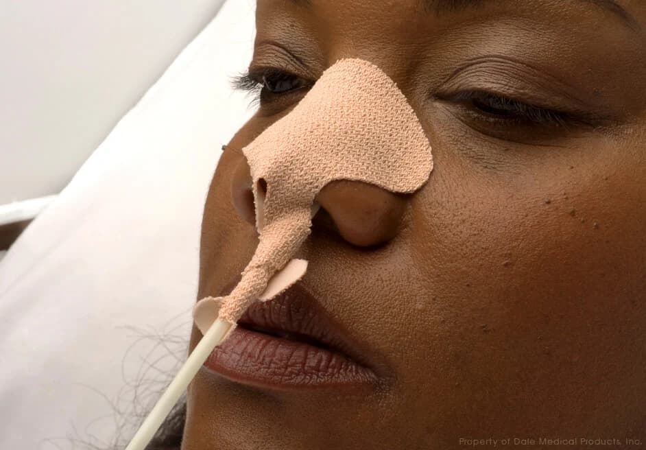 Nasogastric Tube Holders